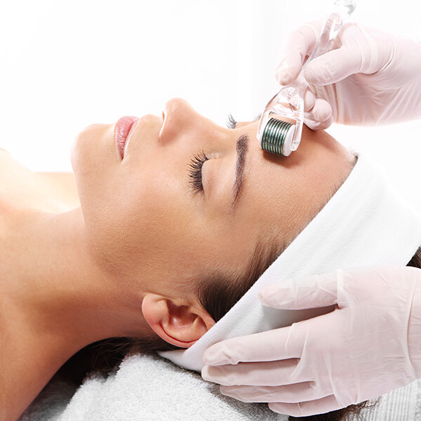 home-microneedling